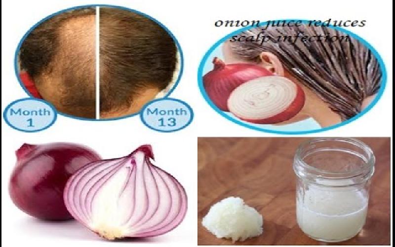 7 Amazing Benefits of Onions for Hair