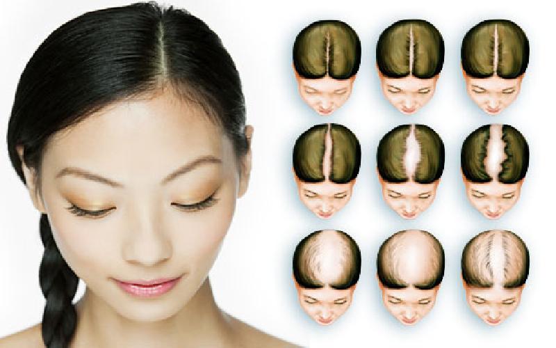 7 Natural Home Remedies To prevent Hair Fall - KalingaTV