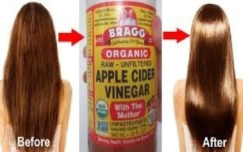 Apple Cider Vinegar for Hair: Benefits and Uses 